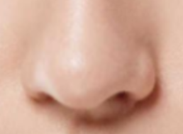 垫鼻尖与开眼角能否“双管齐下”？专家建议：分阶段更安全！