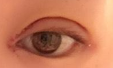 全切双眼皮：解锁眼部焕变，这些问题一网打尽！