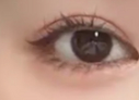 埋线双眼皮消肿秘籍大公开！3招让你快速恢复迷人电眼