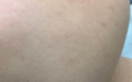 解锁青春密码：皮肤紧致提升，重拾紧致轮廓的秘密武器