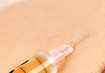 哺乳期注射除皱？医生紧急叫停！药物入乳或危害婴儿健康