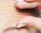 备孕/孕期除皱针禁忌！医生紧急提醒：胎儿安全比美丽更重要