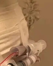 隆胸术后乳房会下垂吗?科学解析与预防指南!