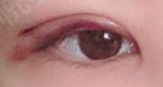 埋线双眼皮术后化妆指南：何时才能美美上妆？