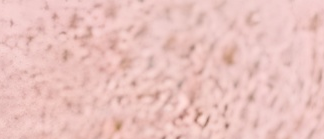 脸上毛孔粗大了的原因找到了？