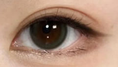 埋线VS切开双眼皮大PK！选对方案，轻松拥有迷人电眼