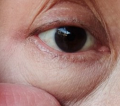 茶叶敷眼“消肿秘籍”大揭秘！茶多酚如何成为晨起救星？