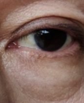 土豆片敷眼“黑科技”大起底!天然成分如何拯救熬夜党的“熊猫眼”?