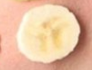 激光美白后反弹？掌握这些要点，轻松维持亮白肌！