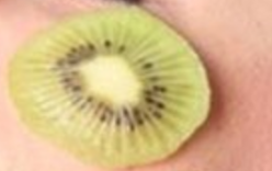 果酸换肤后爆痘，是正常现象还是治疗失误？一文揭秘真相！