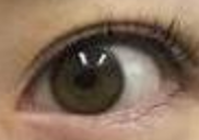 全切双眼皮术前沟通秘籍：三步让医生精准get你的美！