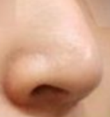 鼻头坏死危机！血运受损、感染、吸烟三大元凶，如何防范？-55545