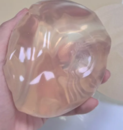 假体隆胸必知！不同放置层次如何影响你的美丽蜕变？-55549