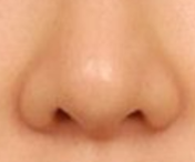 鼻头矫正后疤痕增生别慌！科学处理攻略来救场