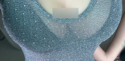 解锁假体隆胸秘密：不同切口位置大揭秘，你选对了吗？