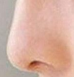鼻头矫正术后会反弹？这些真相你必须知道！