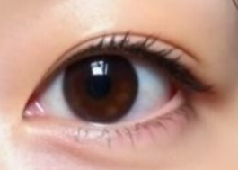 全切双眼皮想加宽？这些关键要点你必须知道！