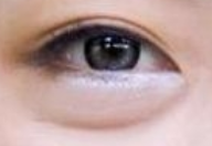 眼袋手术后视力会受影响吗？一文揭秘术后风险与应对