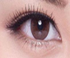 疤痕体质者全切双眼皮：美丽与风险的天平如何平衡？-55576