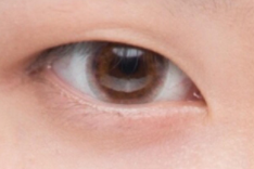 全切双眼皮价格大揭秘：5000 - 10000元背后的秘密！-55586