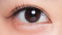 近视眼星人全切双眼皮攻略：安全变美，角膜保护是关键！