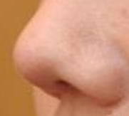 鼻翼矫正术前必看！医生紧急提醒：术前1周不戒烟，可能让手术效果大打折扣！