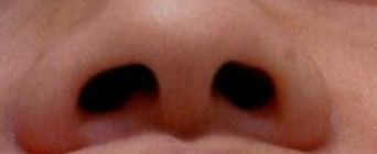 女性生理期做鼻翼矫正手术？这些风险你一定要知道！-55583