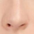 鼻翼矫正假体材料大比拼，选对才能美得自然又安心！-55592