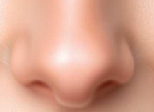 鼻翼填充效果能撑几年？注射VS脂肪移植，一文看懂持久度真相！