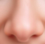 鼻翼矫正术能“拯救”哪些鼻子？先天畸形、外伤缺损，一文解锁个性化修复方案！