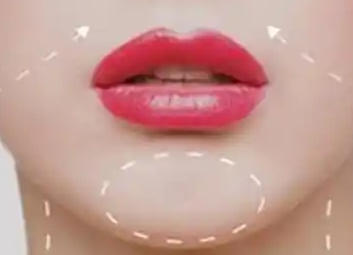 结构型法令纹大揭秘：成因、判断与解决全指南！