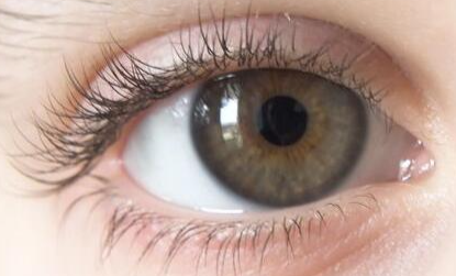 埋线双眼皮术后形态不满意？别急！恢复后还能重新调整！-55625