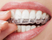 矫正后牙齿敏感别慌！三招教你轻松应对