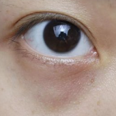 土豆片敷黑眼圈是“民间偏方”还是真有效？科学解析+正确用法，看完不踩坑！-55634