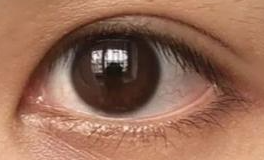 面对双眼皮评价纷扰？坚定自我，静待自然之美绽放！