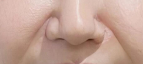 探店实测｜注射除皱后暴晒真相：你的“变美投资”正在被紫外线“偷走”！