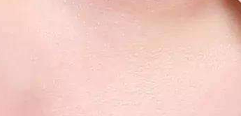 美白面膜使用频率大揭秘：切勿天天敷！-55650