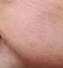 注射除皱后抽烟？这些“隐形杀手”正在摧毁你的变美投资！