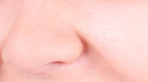 美白产品使用前：去角质，是必要步骤还是多此一举？