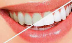 健康牙齿的“本色”：淡黄背后的科学密码-55704