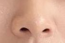 鼻孔矫正手术：女性生理期能否进行？-55716