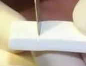 科学预防隆鼻并发症：从机构选择到术后护理的全流程指南