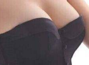 复合隆胸：精准匹配，哪些人群的“理想之选”？-55731