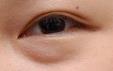 男性眼袋和女性眼袋：差异几何？