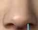 探店鼻整形机构：揭秘鼻头矫正术后鼻头变硬真相