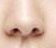 鼻头矫正假体移位应对测评：从轻微到严重的解决方案全解析