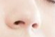 鼻型矫正术前：心理准备不可忽视
