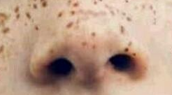 淡斑抗老双管齐下：科学护肤解锁年轻透亮肌