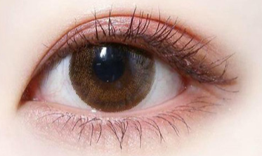 双眼皮术后脱落危机：科学避坑指南与修复策略