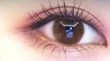 双眼皮术后运动指南：探店三家医美机构解锁安全恢复时间表